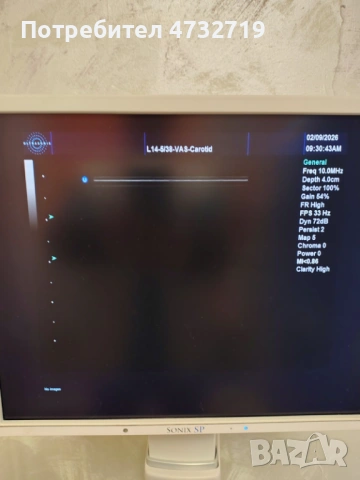 Продавам  ехограф Sonix с  5 трансдюсера - вкл. 3D/4D трансдюсер, снимка 3 - Медицински, стоматологични - 53412006