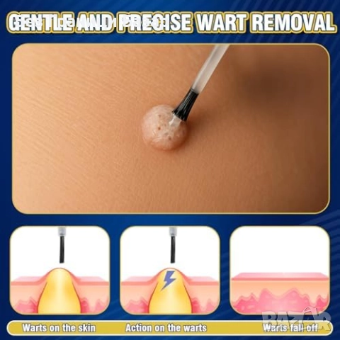 Нов Билков разтвор срещу брадавици и мазоли за ръце и крака 20 мл, снимка 5 - Други - 52123590