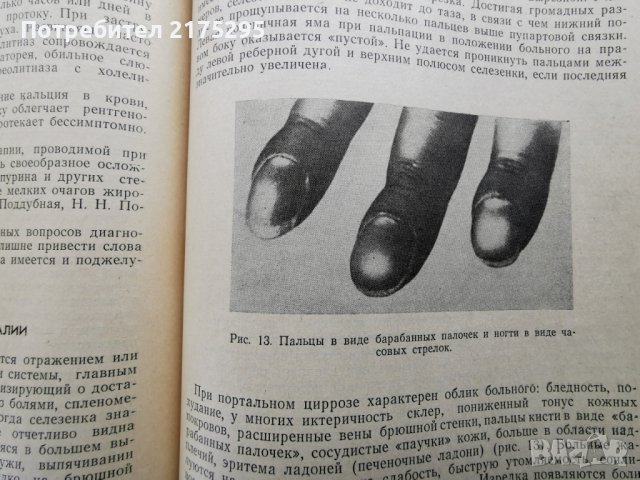 Симптоматична диагностика на хирургичните заболявания-1973г.руско издание, снимка 4 - Специализирана литература - 44592478