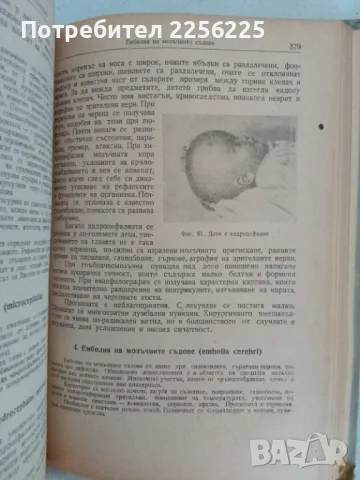 Учебник по детски болести, снимка 6 - Специализирана литература - 47482853