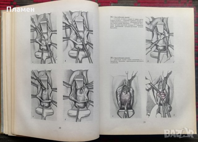 Атлас гинекологических операций /Руски език/, снимка 7 - Специализирана литература - 35835220