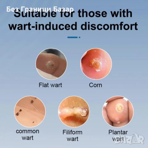 Нов Натурален гел в писалка за отстраняване на брадавици и кожни тагове, снимка 3 - Други - 52697112