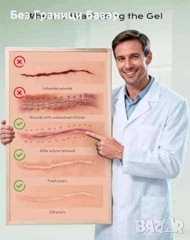 Нов Силиконов гел за белези 15g – операции, келоиди, изгаряния, акне, снимка 7 - Други - 52939048