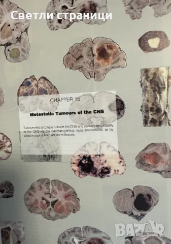 World Classification of Tumours of The Central Nervous System, снимка 4 - Специализирана литература - 48316593