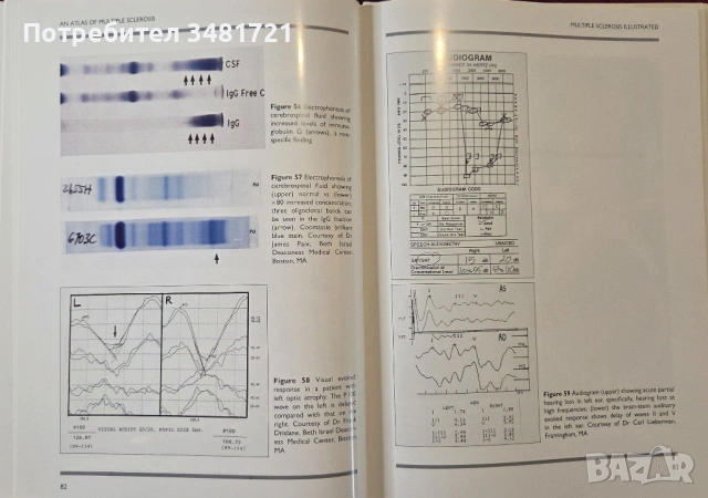 Голям атлас на множествената склероза / An Atlas of Multiple Sclerosis, снимка 11 - Специализирана литература - 53748194