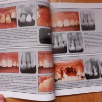 Травматизирани зъби- лечение, Митсухиро Тсукибоши, снимка 4 - Специализирана литература - 43910903