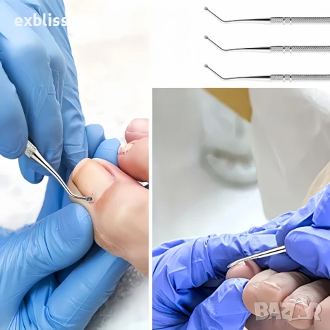Инструмент за корекция на врастнали нокти, снимка 7 - Продукти за маникюр - 50761150