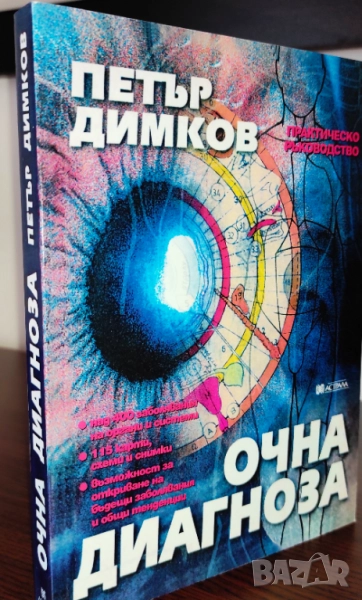 (Продава се само във Варна - лична среща) Очна диагноза - Петър Димков, снимка 1