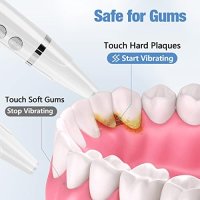 Нов Комплект за почистване на зъби с 5 режима Устна хигиена Петна Зъбен камък, снимка 8 - Други - 41766325