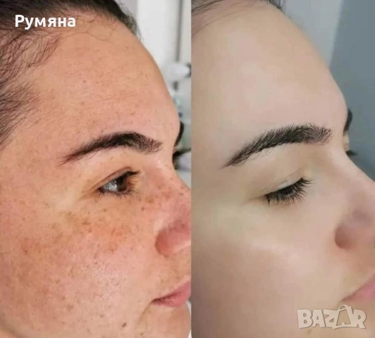 Пчелен мехлем срещу пигментни петна , снимка 2 - Други - 49271744