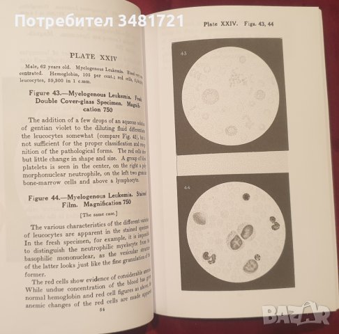 Хематологичен атлас / Hematological Atlas, снимка 8 - Енциклопедии, справочници - 41376805