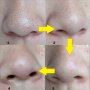 Ленти за премахване на черни точки от носа и лицето 15 бр., снимка 6