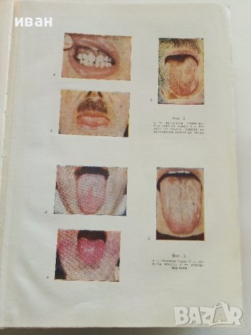 Учебник по Вътрешни болести в 2 тома - К.Чилов,Т.Ташев,М.Рашев, снимка 7 - Учебници, учебни тетрадки - 40187997