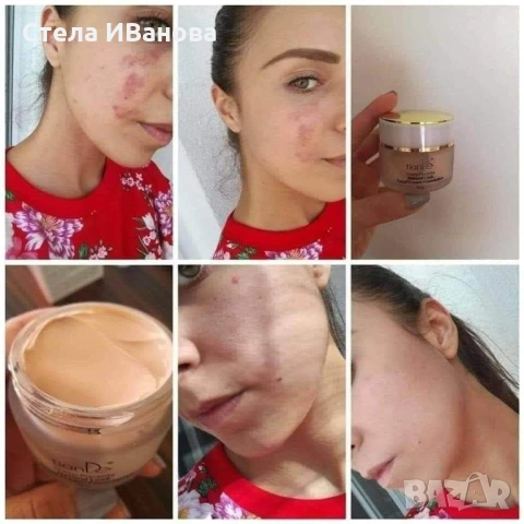 Крем за скриване на несъвършенства, петна и акне - маскира, хидратира. По-добър от фон дьо тен, снимка 8 - Козметика за лице - 53393168