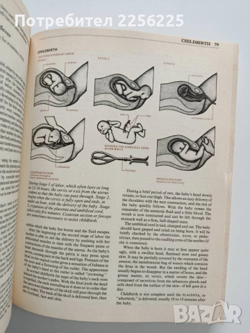 Семейна медицинска енциклопедия/Илюстровано ръководство, снимка 8 - Енциклопедии, справочници - 53402398