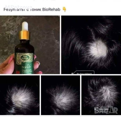 Тоник активатор за растеж на косата, снимка 8 - Продукти за коса - 34151171