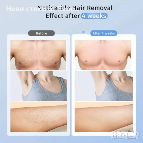 Безболезнено IPL устройство за лазерна епилация с 41,0°F ледено охлаждане, 3 в 1 , снимка 6 - Епилатори - 49846404