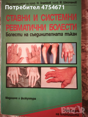 Ставни и системни ревматични болести 