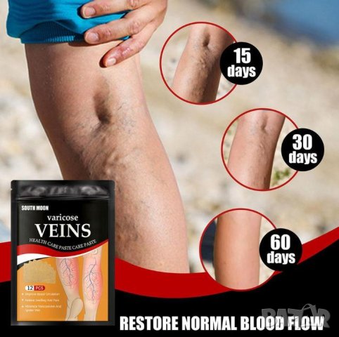 Детокс Лепенки за Разширени Вени Варикозни Капиляри Варикоза Флебит Атеросклероза Тежки Подути Крака, снимка 11 - Други - 41329206