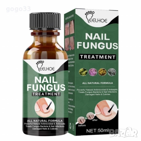 лак против гъбички , снимка 3 - Други - 51861216