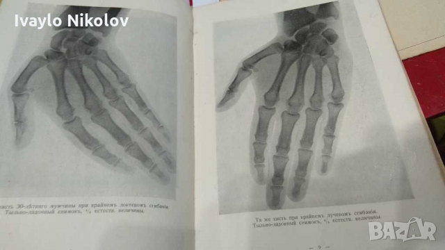 1921 Анатомически атлас на Руски издаден в Берлин , снимка 5 - Енциклопедии, справочници - 36093069