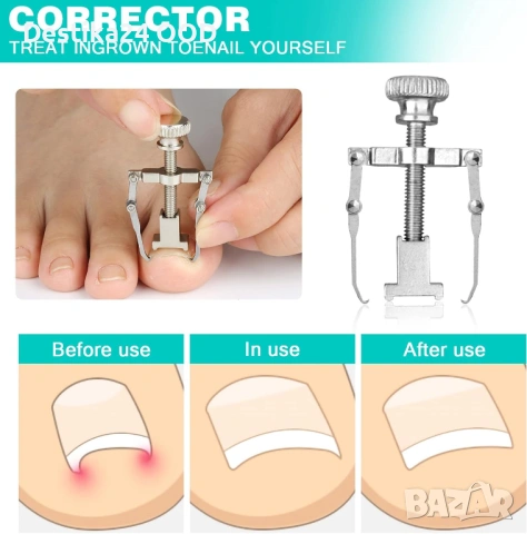 Комплект инструменти за педикюр – нокторезачки за дебели и впити нокти, снимка 4 - Продукти за маникюр - 53735210