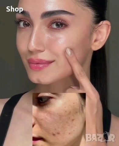 -50% Tretinoin cream , снимка 3 - Козметика за лице - 53343110