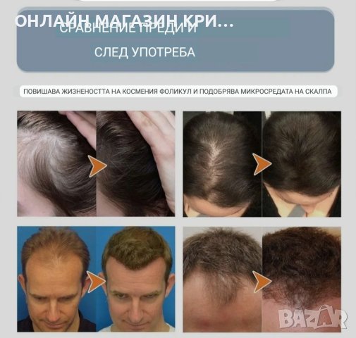 Подхранващ скраб за коса против косопад Крижа за косата Скраб почистване за възтановяване на увред , снимка 8 - Аксесоари за коса - 41556460