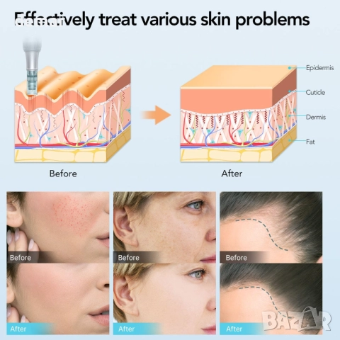Dr. Pen Микронидлинг писалка M7S 2025 с 18 патрона, 6 скорости, снимка 6 - Други - 52291840