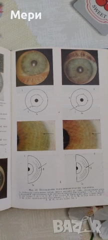 Иридодиагностика, снимка 4 - Други - 53768504