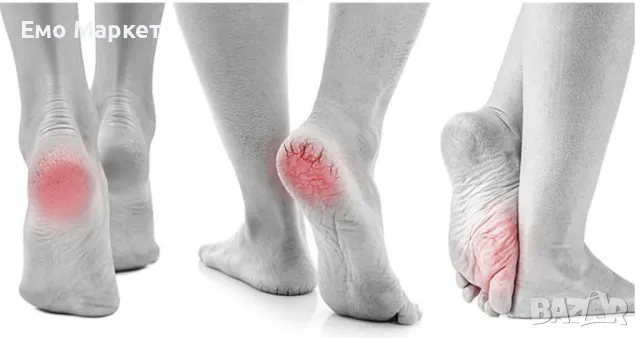 Електрическият уред за премахване на мъртва кожа от петите, снимка 11 - Други стоки за дома - 49020660