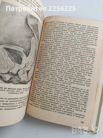 Венерически и невенерически полови болести у мъжа и жената , снимка 10 - Специализирана литература - 53678124