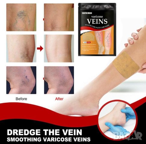 Детокс Лепенки за Разширени Вени Варикозни Капиляри Варикоза Флебит Атеросклероза Тежки Подути Крака, снимка 10 - Други - 41329206