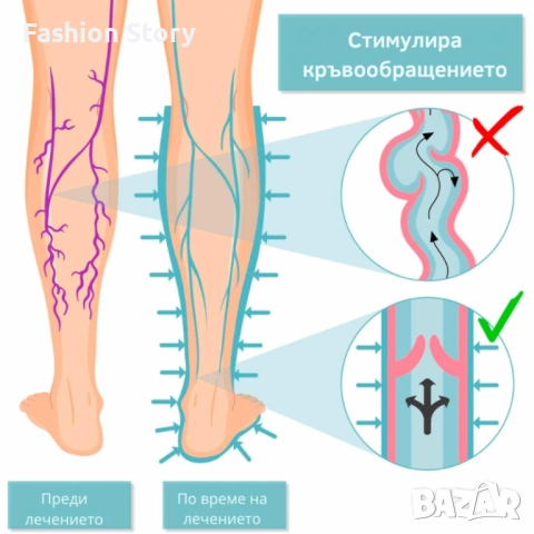 Апарат за венозна тренировка и облекчение на тежестта в краката Venen Walker Basic, снимка 2 - Други - 51855876