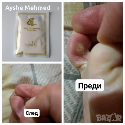 Профилактичен крем със змийска мас, 30 гр