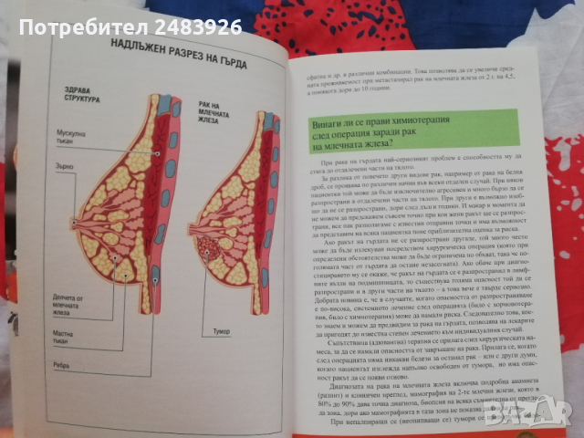 Докторе кажи!50  въпроса  за... Рака  Антоанета Томова, снимка 2 - Специализирана литература - 44574338