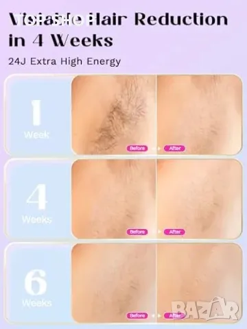 Нов Лазерен уред за епилация с ледена охлаждаща функция за гладка кожа, снимка 2 - Тримери - 49732388