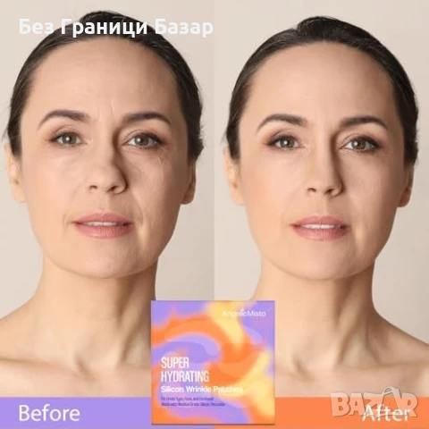 Нови Силиконови лепенки против бръчки за чело и лице – многократна употреба, снимка 4 - Други - 51106886