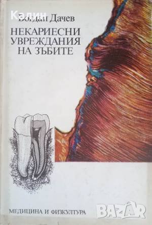 Некариесни увреждания на зъбите-Богдан Дачев