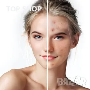 Уред за премахване на черни точки, акне и абразио Frohmen Prof, снимка 2 - Маши за коса - 48472479