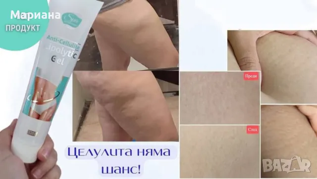 Премахване на целулит, отоци и вени, снимка 2 - Козметика за тяло - 48874618