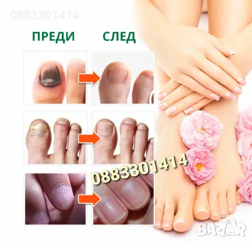 Спрей за нокти Премахва гъбички на ноктите , снимка 4 - Продукти за маникюр - 50094300