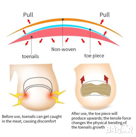 Стикери за Корекция на Нокти Нормализиране Обърнати Нокти Деформирани Нокти Изкривени Нокти Растеж, снимка 7 - Други - 40897949