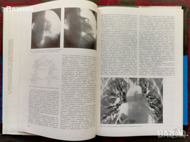 Рентгенова и радиоизотопна диагностика на заболяванията на сърцето и големите съдове, снимка 2 - Специализирана литература - 35848291