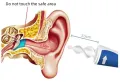 Уред за почистване на уши, снимка 7