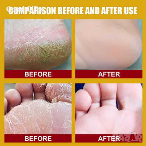 Ексфолиращ крем за напукана кожа EELHOE Грижа за ръцете и краката, снимка 5 - Козметика за тяло - 40678402