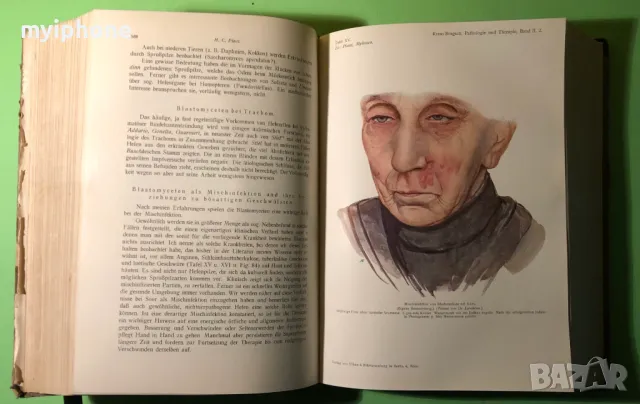 Стара Книга Патология и Лечение на Инфекциозни Болести 2 част 1919 г./1271 страници, снимка 9 - Специализирана литература - 49160295