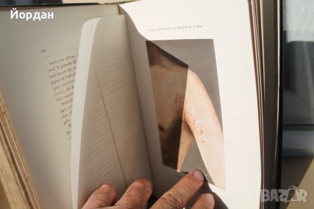 Френска медицинска книга за кожни заболявания, снимка 9 - Специализирана литература - 42654446