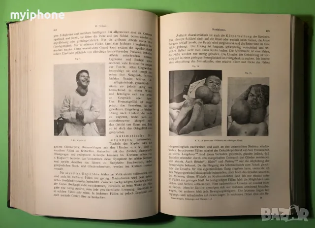 Стара Книга Болести на Обмяната Болести на Жлезите с Вътрешна секреция, снимка 6 - Специализирана литература - 49204935