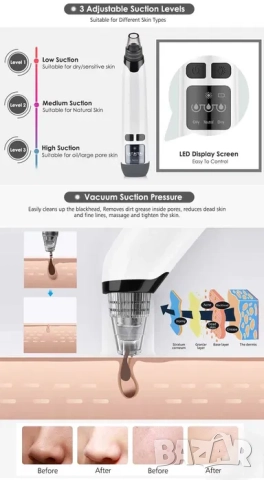 Вакуум Уред за почистване на черни точки по лицето с горещ компрес, снимка 5 - Други - 52198268
